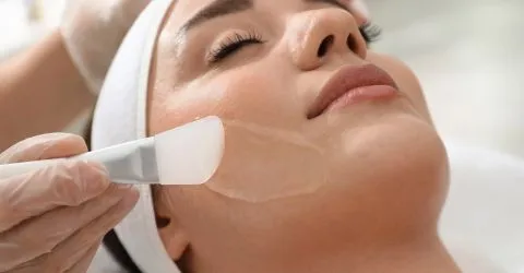 Chemical Peels